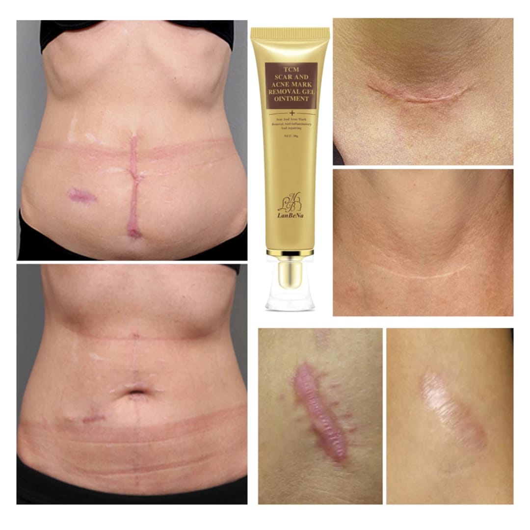 Removedor de cicatrizes 